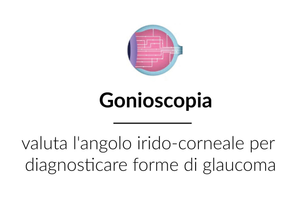 spiegazione gonioscopia