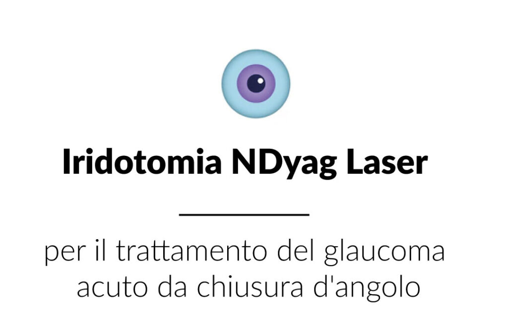 spiegazione iridotomia